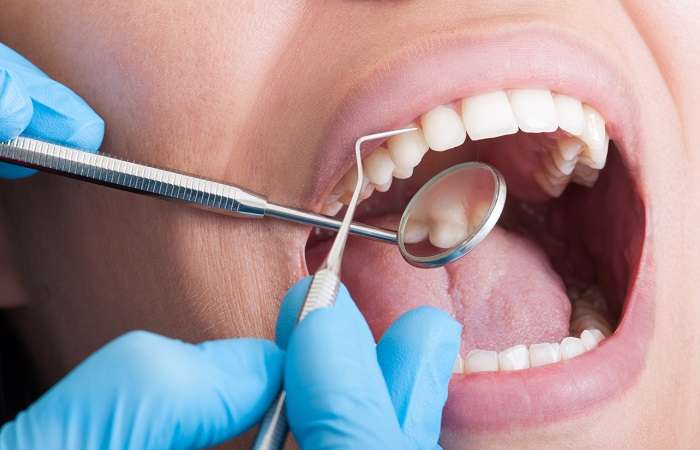 dentista realizando limpeza nos dentes