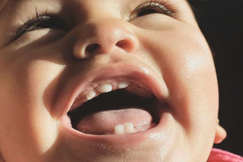 Sapinho-em-bebes-entenda-os-sintomas-causas-e-ocorrencias-em-adultos-1